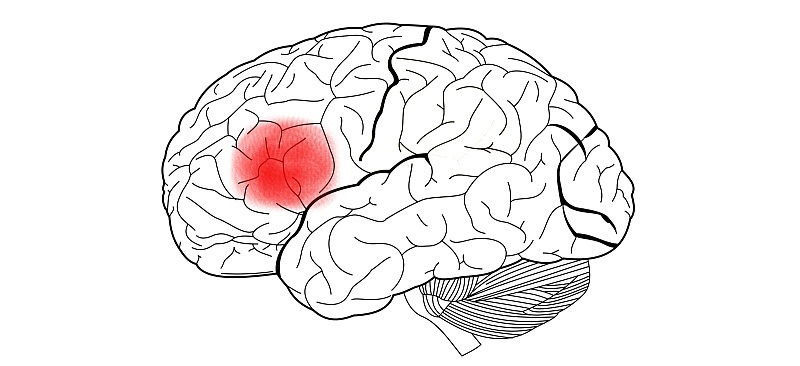 brocas-area